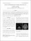 Bilateral striopallidodentate calcinosis in a patient with myasthenia gravis