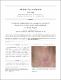 목에 발병한 무증상 다발털평활근종 =Asymptomatic multiple piloleiomyoma occurring on the neck